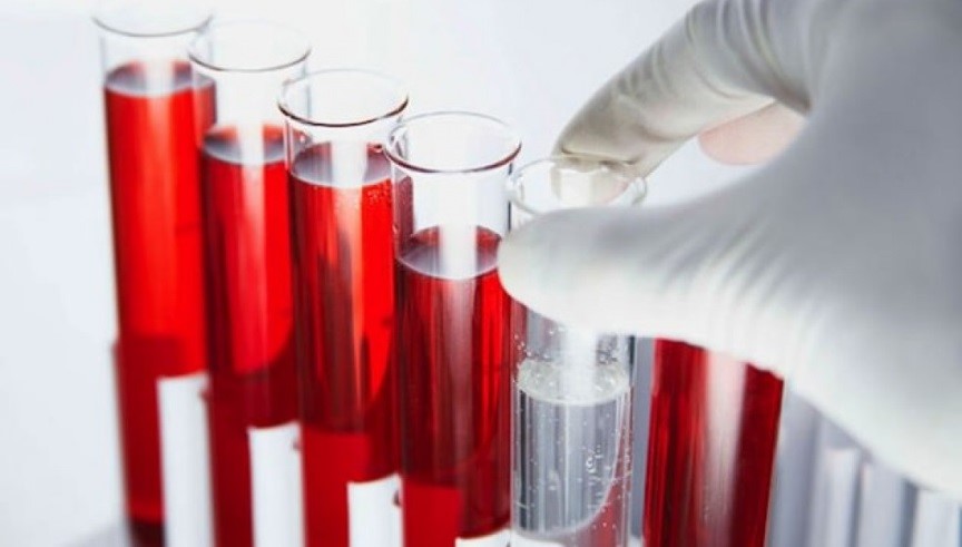 Общий клинический анализ крови: показатели и расшифровка результатов
