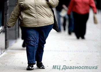 Ожирение - проблема века