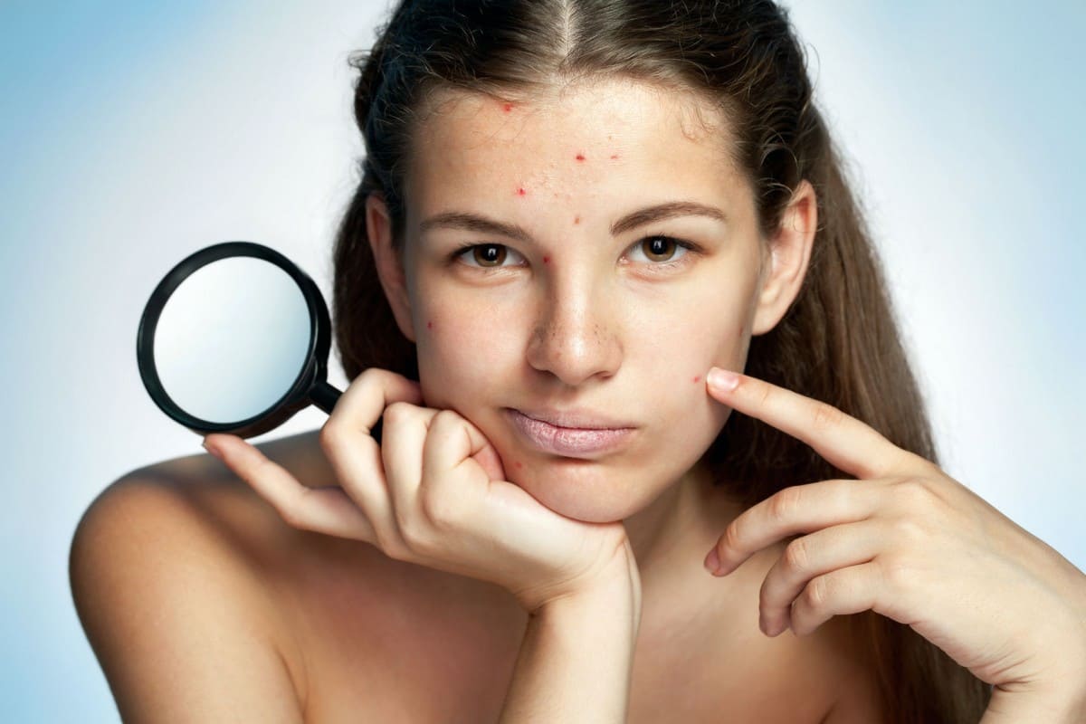 Аллергическая сыпь на лице и теле - причины и лечение